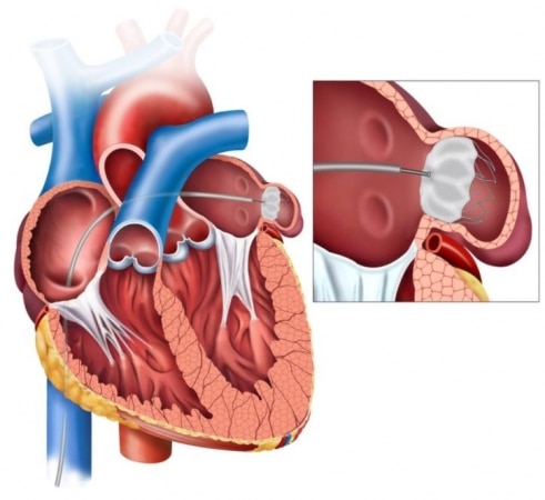 drawing of human heart cut if half